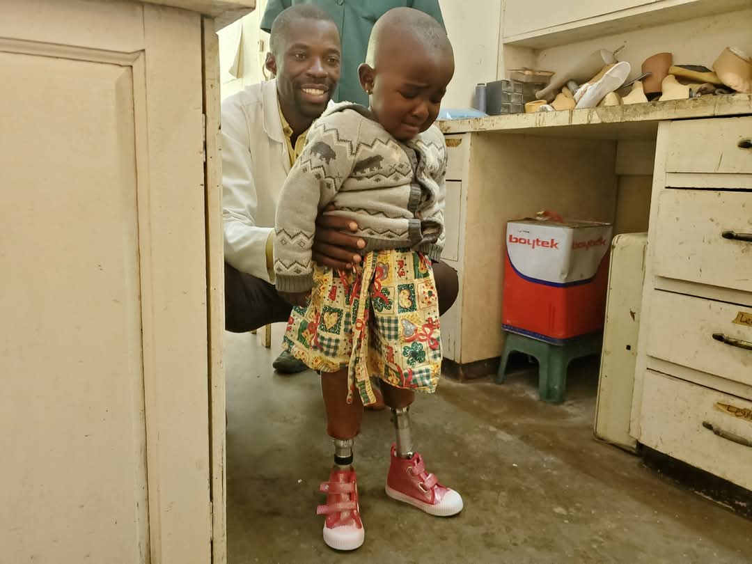 Prosthetic fitting